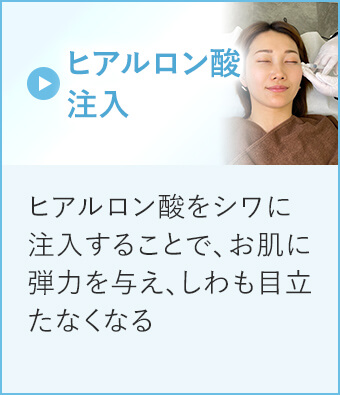 ヒアルロン酸注入
