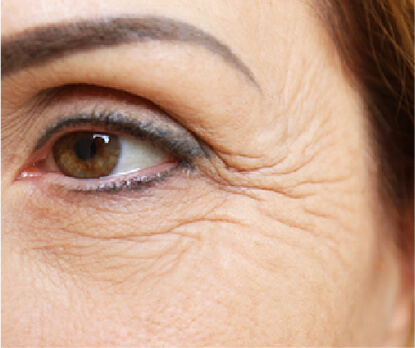 お肌のハリ・小ジワ