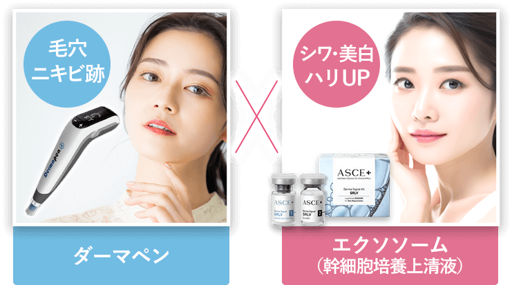 ダーマペン＋エクソソーム