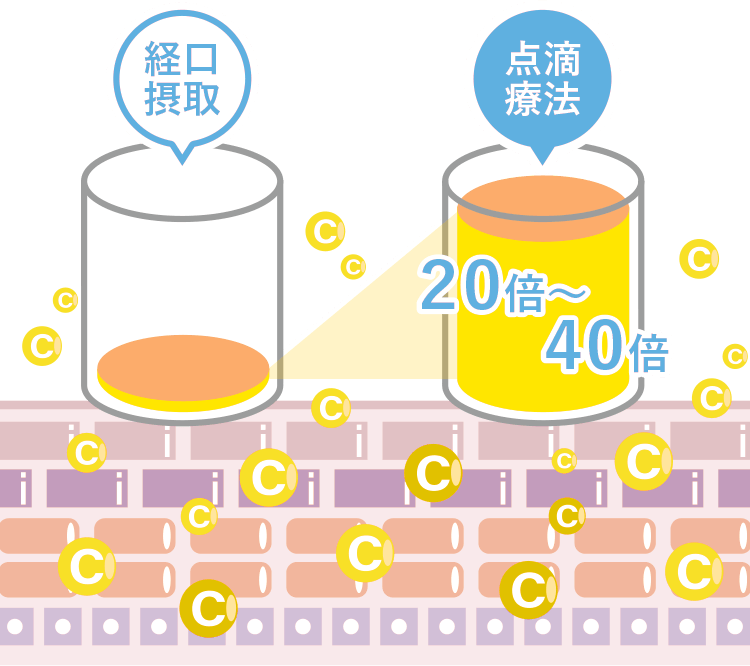 点滴療法と経口療法の違いは？