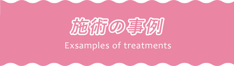 ヒアルロン酸注入はこんな悩みを即日解消します