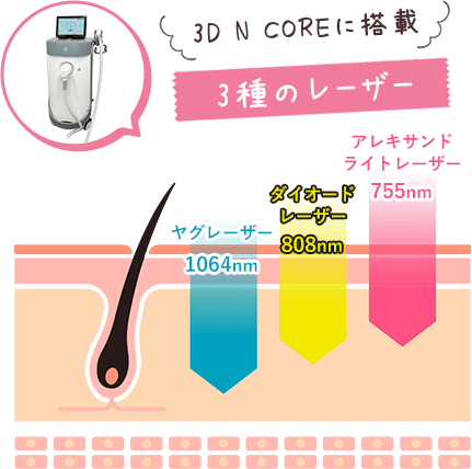 3D N COREに搭載 3種のレーザー