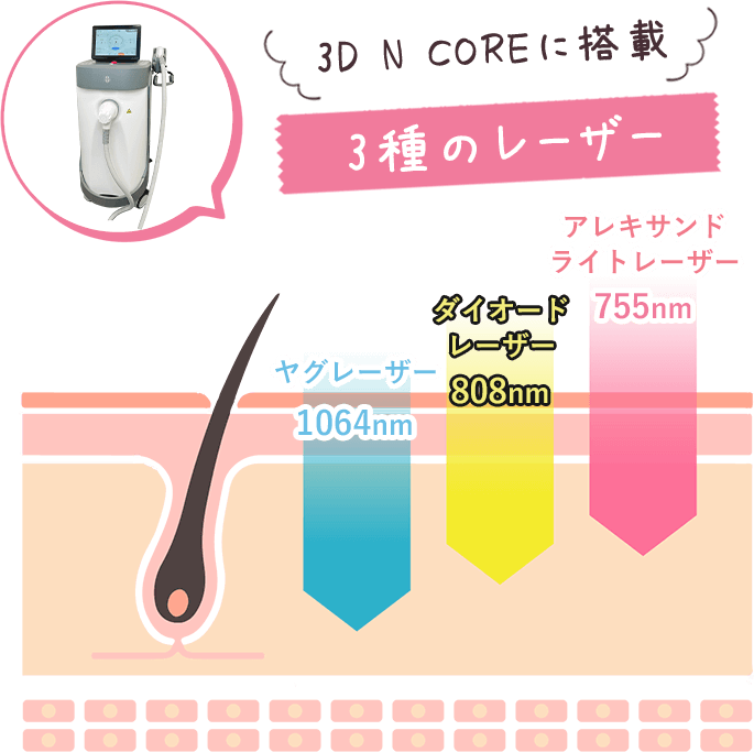 3D N COREに搭載 3種のレーザー