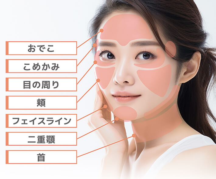 おでこ こめかみ 目の周り 頬 フェイスライン 二重顎 首