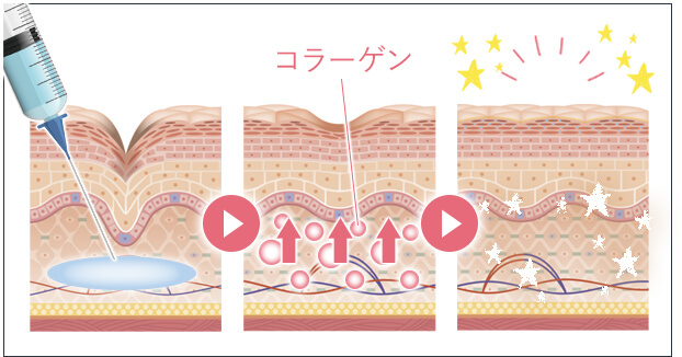 ジュベルックとは？