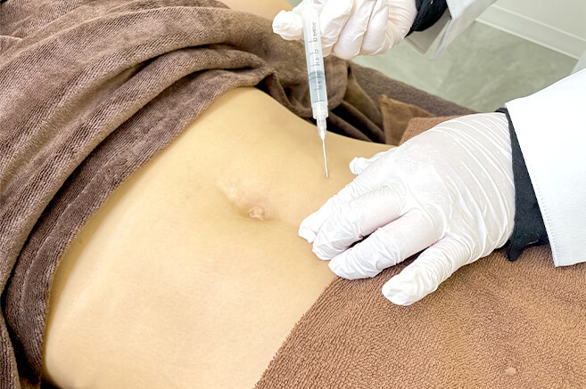脂肪溶解注射は1回でも効果がある？