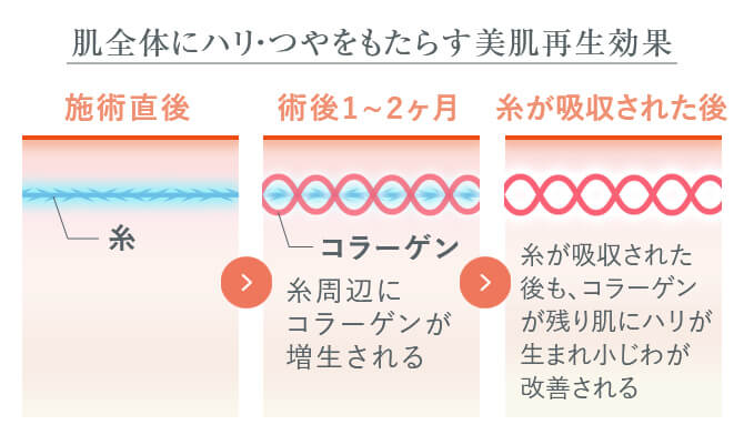 肌の若返りが期待できる！