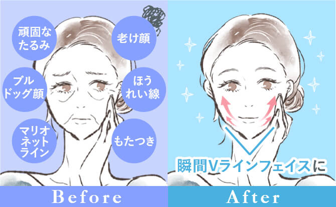 Before Afterイメージ