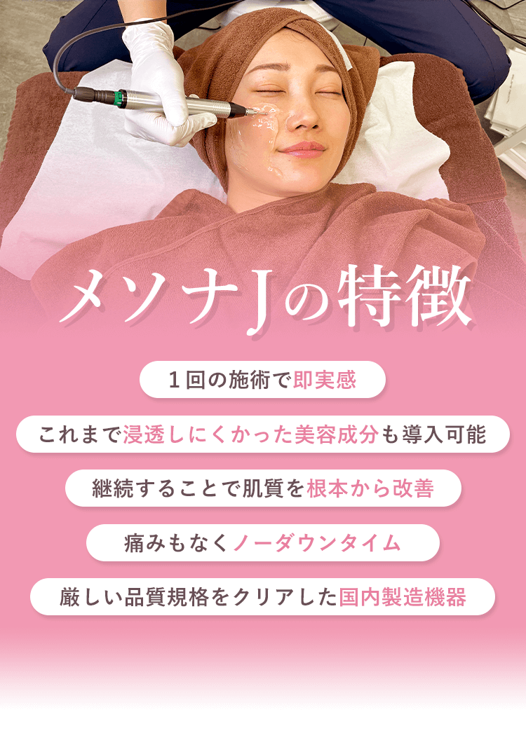 メソナJの特徴