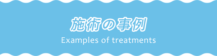 施術の事例