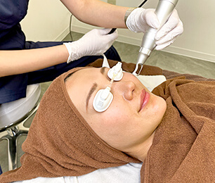 レーザートーニング