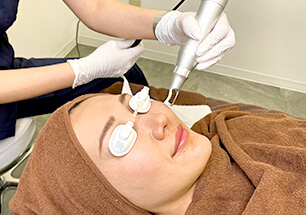 レーザートーニング